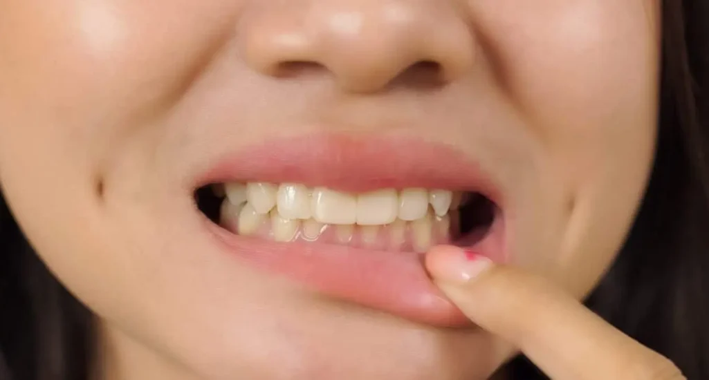 jpeg-optimizer_DSC02467 jpeg-optimizer_DSC02467